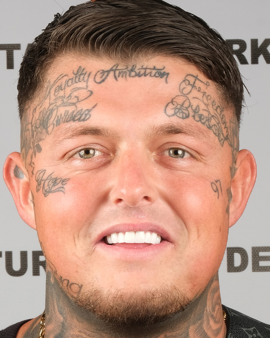 34