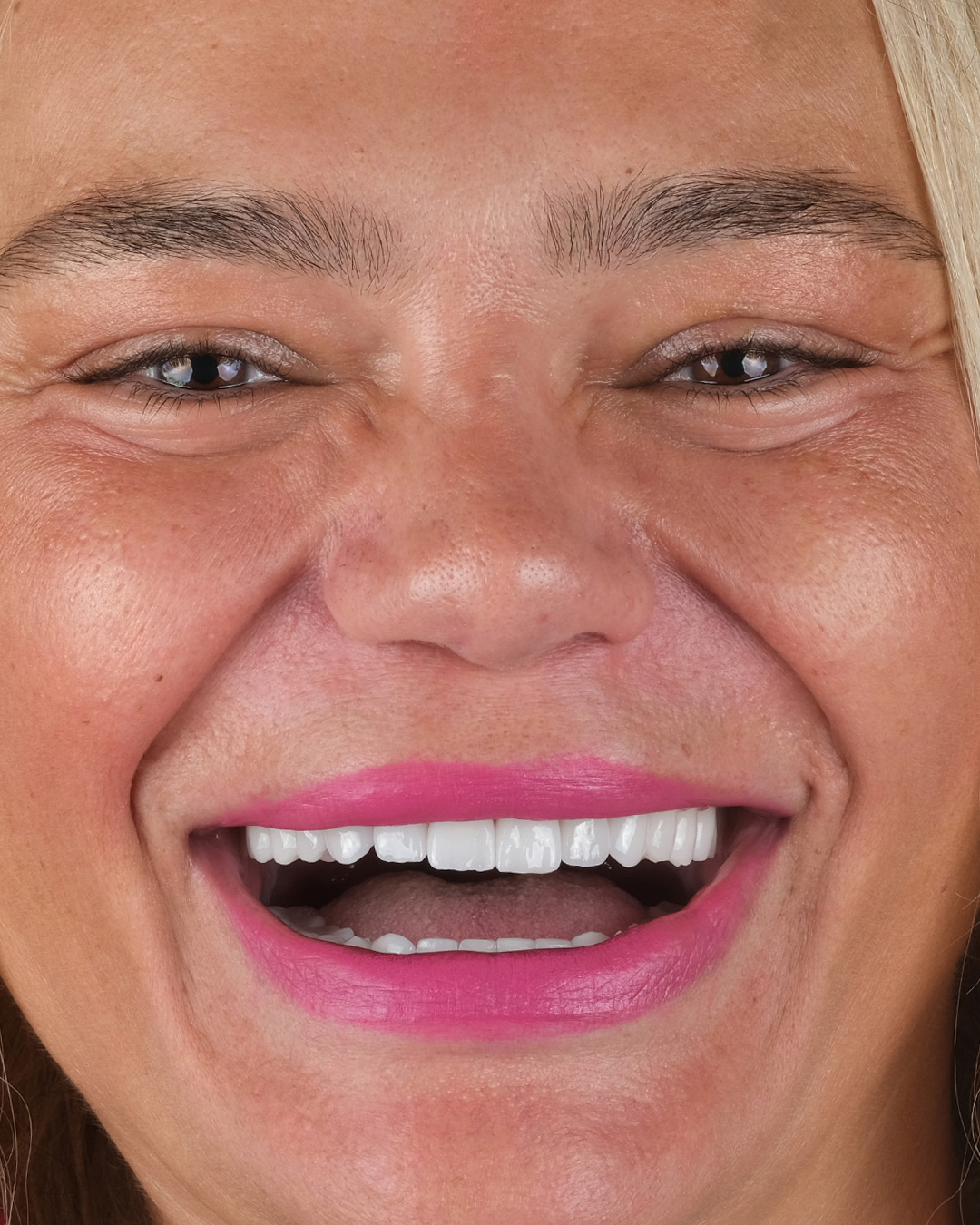 62